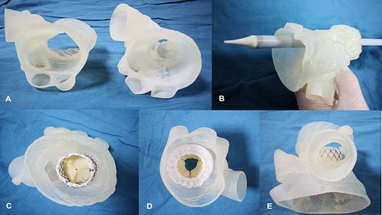 逐渐纳入医保范围的3D打印模型，将会对医工结合带来哪些不同？